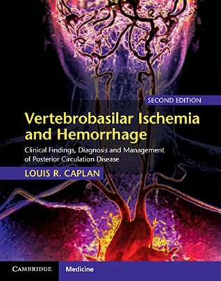 Read online Vertebrobasilar Ischemia and Hemorrhage: Clinical Findings, Diagnosis and Management of Posterior Circulation Disease - Louis R. Caplan | PDF